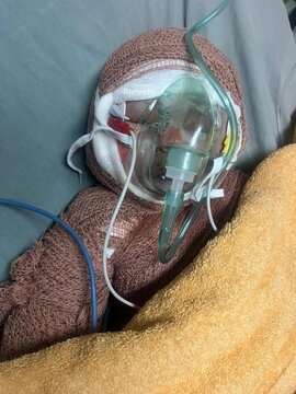 کوچک‌ترین شهید ایران؛ این تصویر تکان‌دهنده است