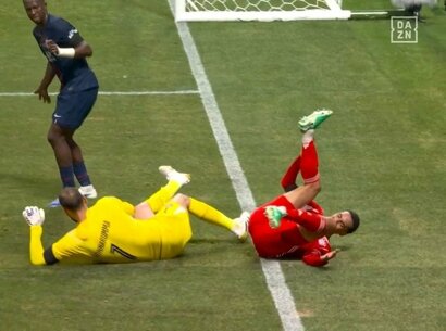 اتفاقی تلخ برای ستاره بایرنمونیخ؛ پای موسیالا شکست +عکس