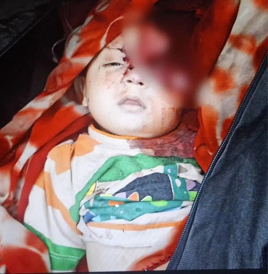 تصویری تلخ از نوزادی که در زاهدان شهید شد