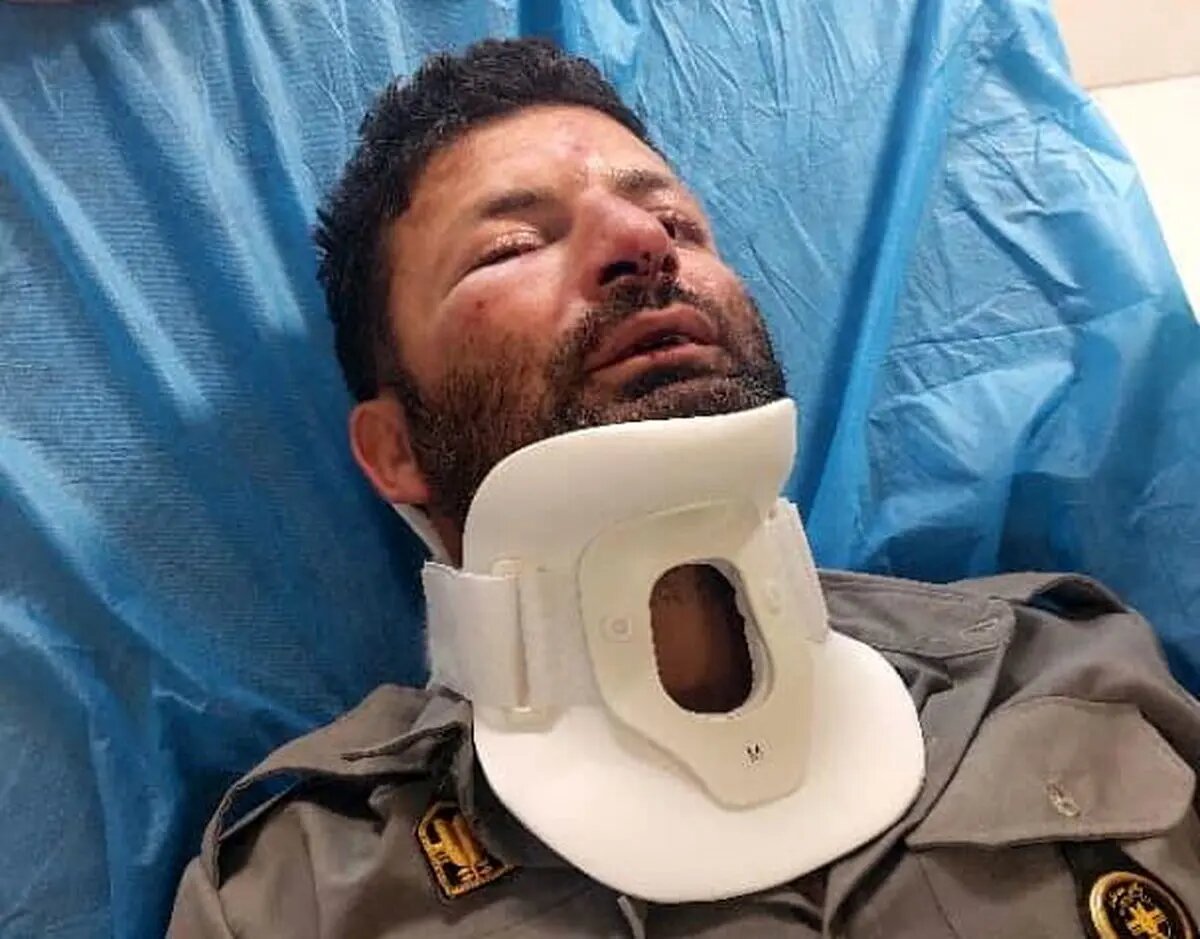 حمله به حافظان طبیعت؛‌ ضرب و شتم یک محیط‌بان توسط سه قانون‌شکن +عکس