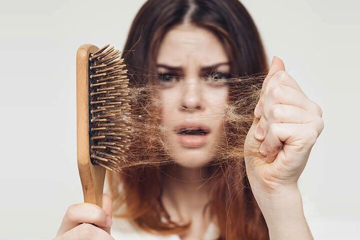 از گوشت قرمز تا نوشیدنی‌های شیرین؛ این خوراکی‌ها باعث ریزش مو می‌شوند