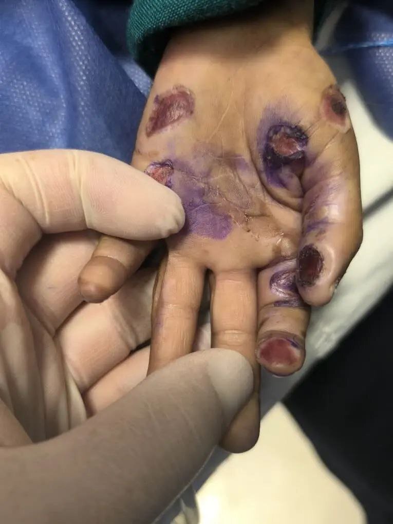 ممکن است دیدن این خبر آزار دهنده است؛ فوت دردناک یک کودک ۴ساله در پی آزار و اذیت