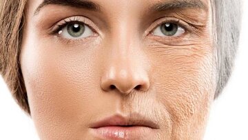 برای یک پوست خوب این ویتامین‌ها را مصرف کنید