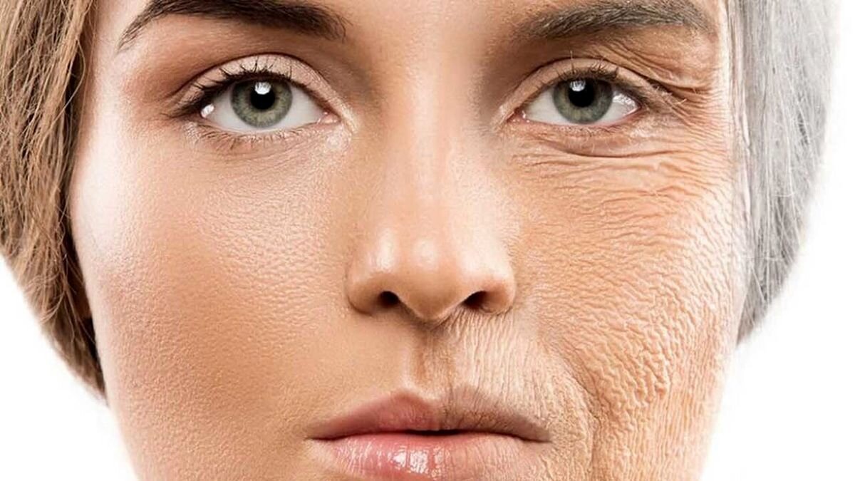 برای یک پوست خوب این ویتامین‌ها را مصرف کنید