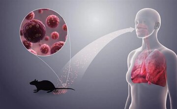 از دست این ویروس خطرناک یک نفس راحت بکشید