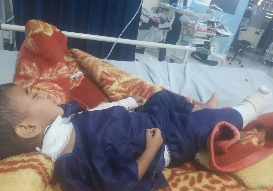 اولین عکس از کودک مجروحِ حملات بامدادی آمریکا