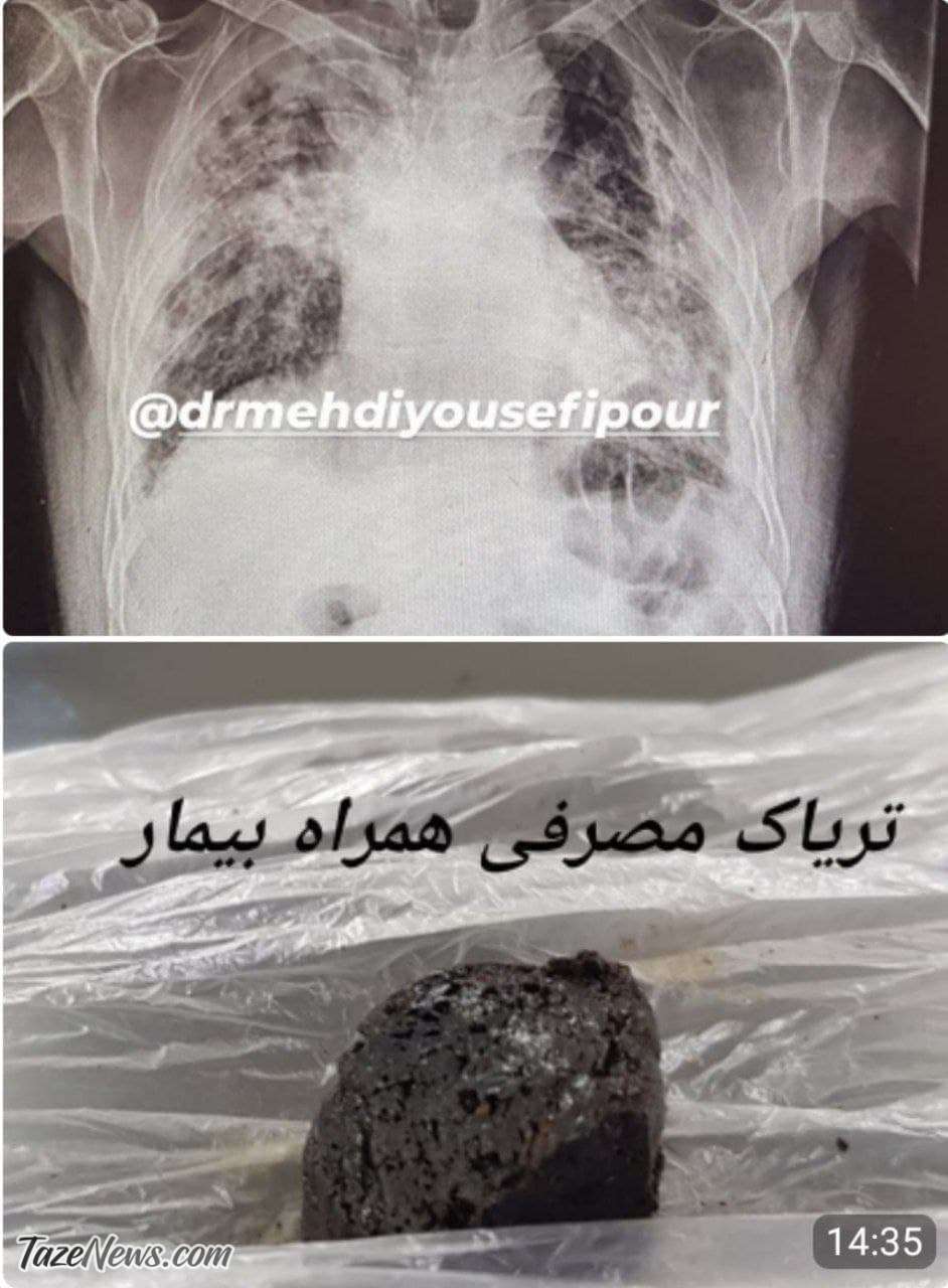 سرنوشت تلخ بیمار کرونایی که در خانه تریاک مصرف می‌کرد +عکس