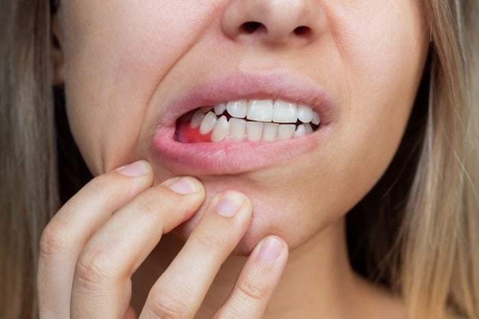 وقتی دندان و لثه از سلامت بدن می‌گویند