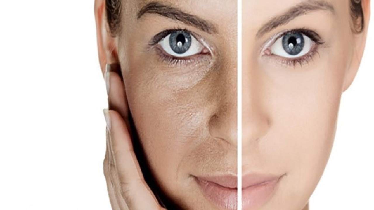 روشهای رفع تیرگی پوست کدامند؟ روشهای رفع تیرگی پوست کدامند؟