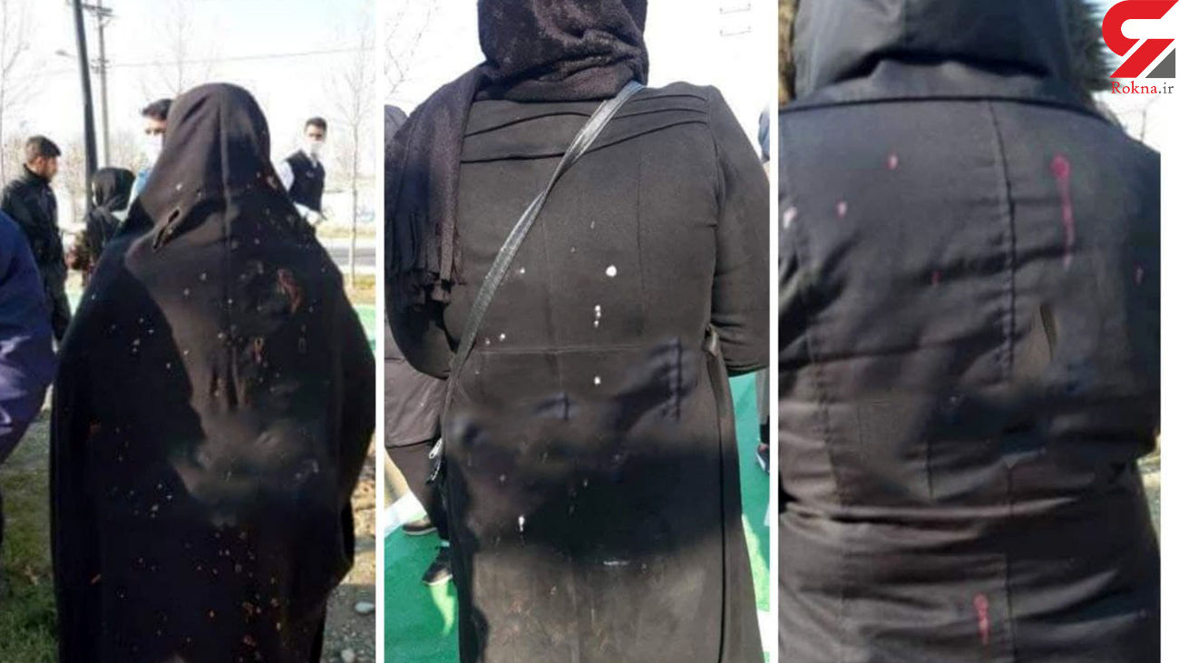اسیدپاشی وحشتناک به زنان تهرانی در شهرک مریم اسیدپاشی وحشتناک به زنان تهرانی در شهرک مریم