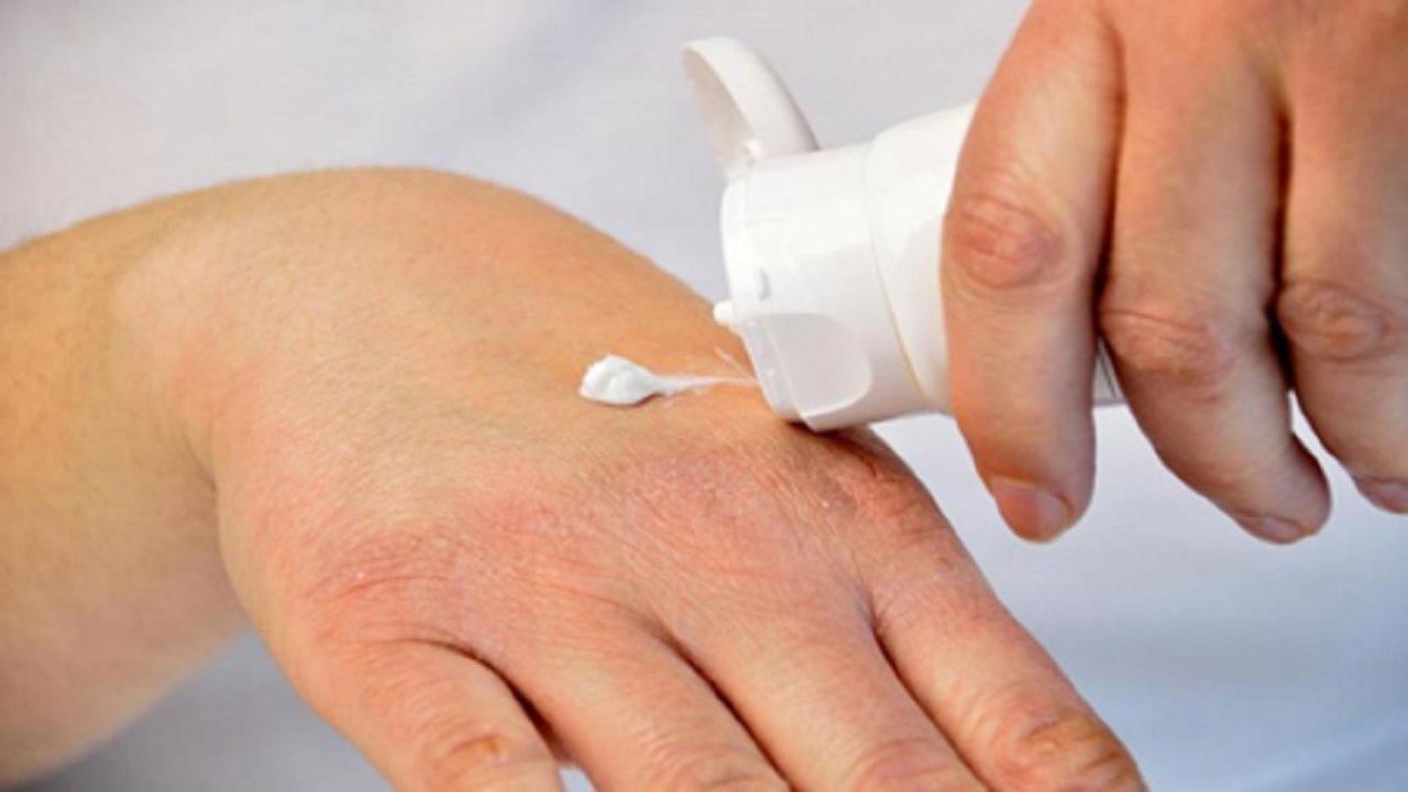 راهکار خانگی برای خلاصی از خشکی پوست راهکار خانگی برای خلاصی از خشکی پوست
