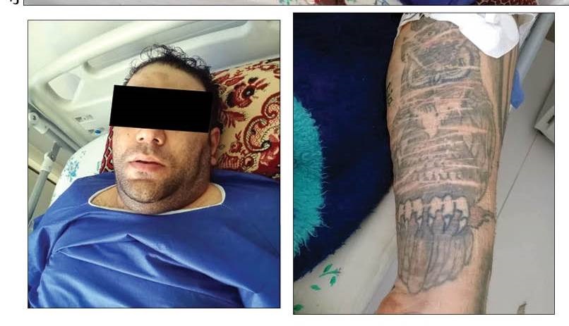 ویراژ مرگ‌بار در خیابان‌های مشهد؛ دزد جوان با شلیک متوقف شد +عکس