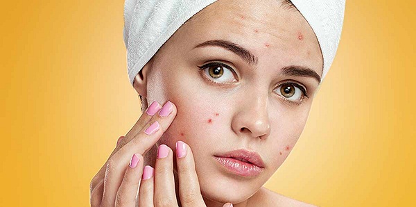 همه چیز درباره لکهای پوستی/ برند و SPF کرم ضدآفتاب چهقدر مهم است؟ همه چیز درباره لکهای پوستی/ برند و SPF کرم ضدآفتاب چهقدر مهم است؟