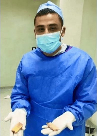 ماجرای مردی که موبایل خود را قورت داد! +تصاویر