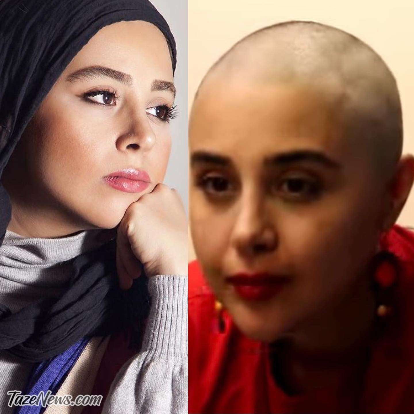 بازیگر زن تلویزیون به سرطان مبتلا شد +عکس