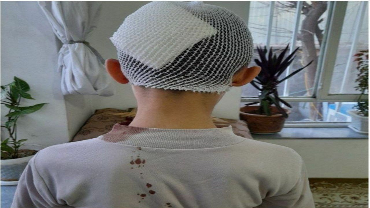 در آغاز بازگشایی دوباره مدارس یک معلم سر دانشآموز را شکست! +عکس در آغاز بازگشایی دوباره مدارس یک معلم سر دانشآموز را شکست! +عکس