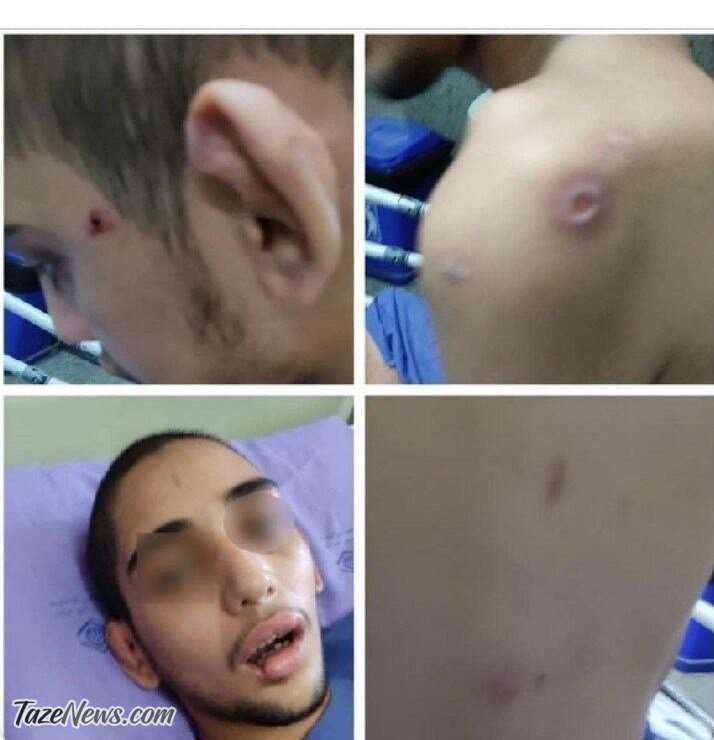 تصاویری تلخ از شکنجه یک ناتوان ذهنی در قائم‌شهر!