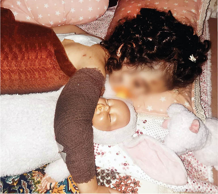 دختر ۳ساله کرجی در چنگال سگهای ولگرد! +عکس دختر ۳ساله کرجی در چنگال سگهای ولگرد! +عکس