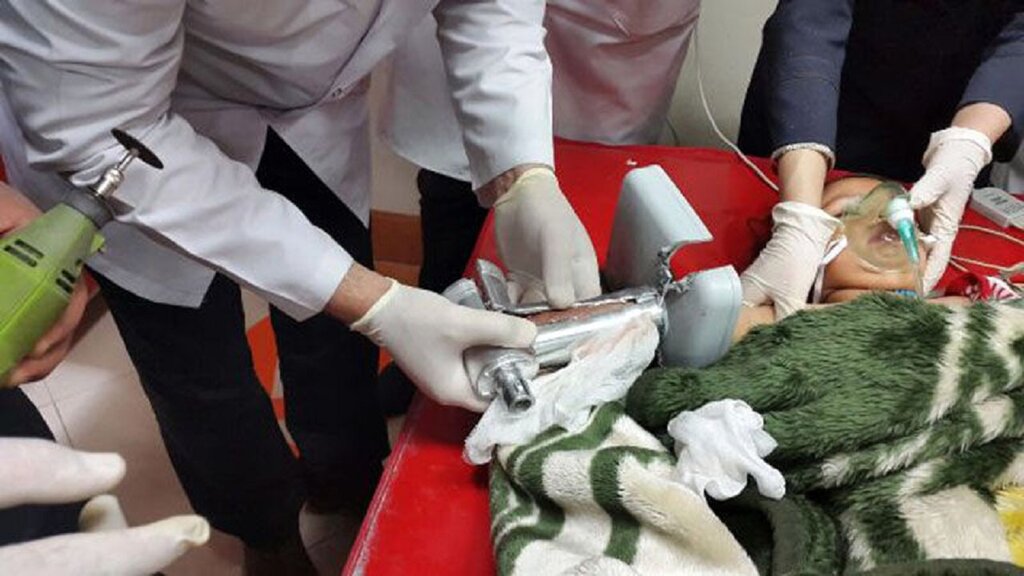 بی‌احتیاطی فاجعه رقم زد؛ چرخ‌گوشت انگشتان کودک ۲ساله را بلعید! +عکس