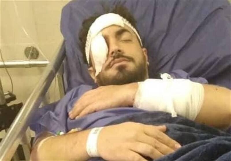 حمله به یک روحانی در تهرانپارس حمله به یک روحانی در تهرانپارس