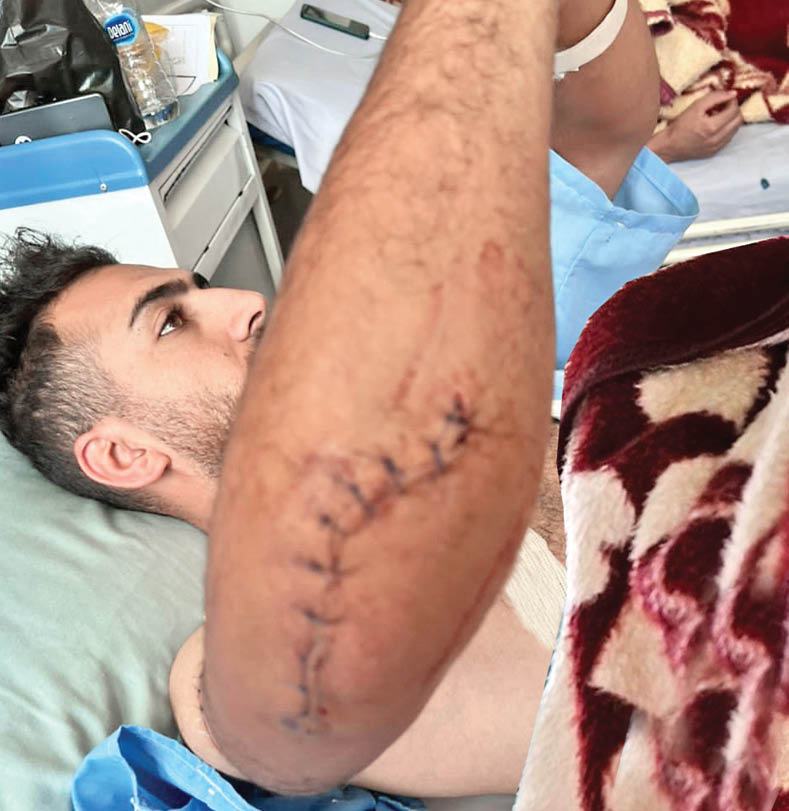 وحشت در کردان؛ سارقان خشن خون به پا کردند! +عکس وحشت در کردان؛ سارقان خشن خون به پا کردند! +عکس