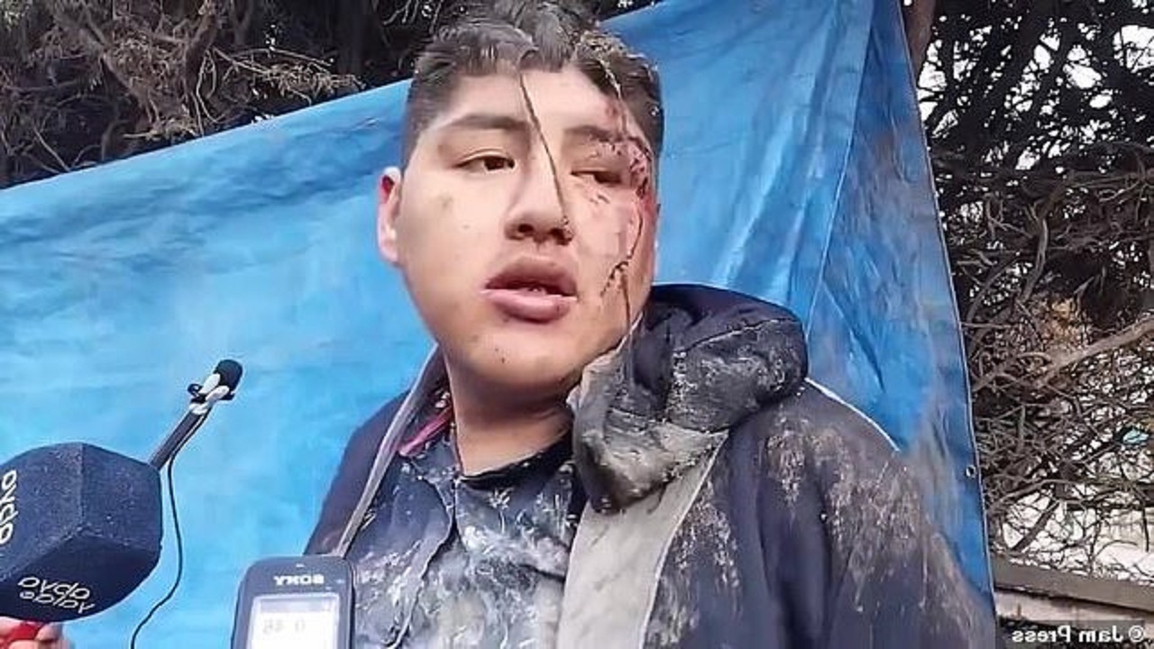 زنده بهگور کردن مرد جوان در یک فستیوال محلی! +ویدئو زنده بهگور کردن مرد جوان در یک فستیوال محلی! +ویدئو