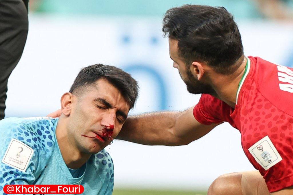 بیرانوند مصدوم شد؛ تعویض اجباری برای ایران مقابل انگلیس