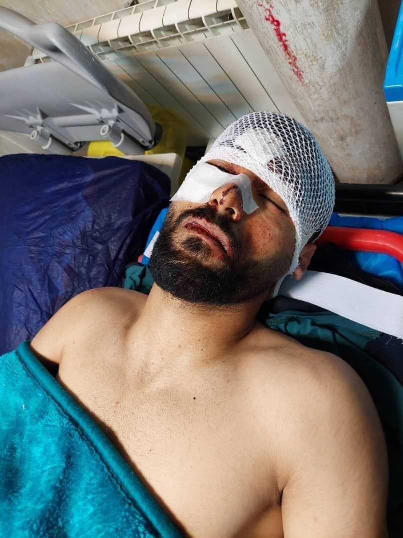 تصادف وحشتناک بازیکن تیم ملی +تصویر دردناک او بعد از سانحه