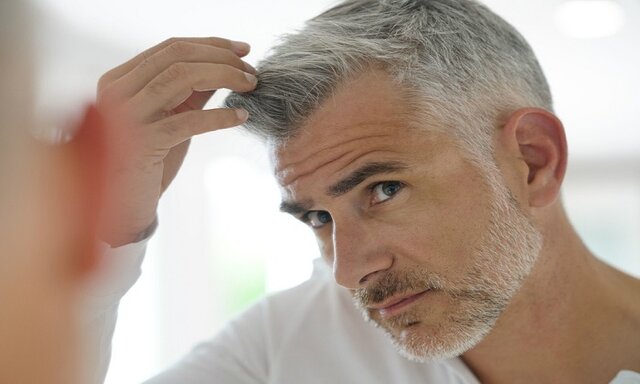 سفیدی و ریزش مو بابت کمبود کدام ویتامین است؟ سفیدی و ریزش مو بابت کمبود کدام ویتامین است؟