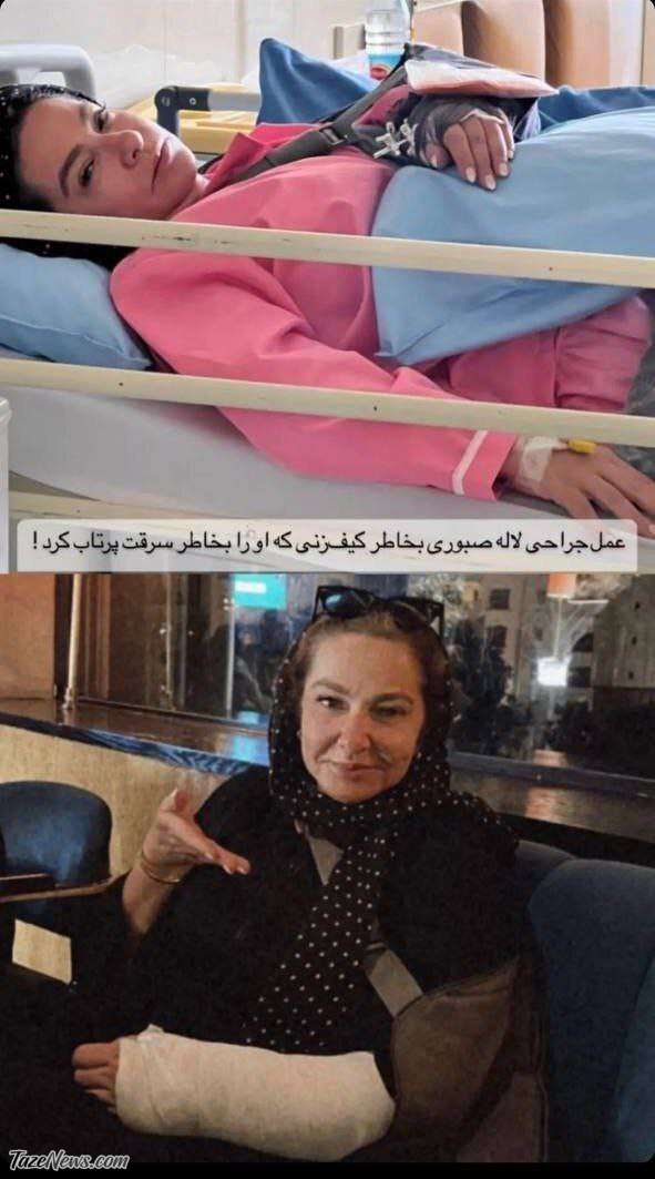 حمله وحشیانه سارقان به بازیگر زن مشهور +عکس
