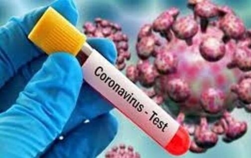 بیش از ۴۰۰۰ ابتلای جدید در روز گذشته به مبتلایان کرونای جهان افزوده شد بیش از ۴۰۰۰ ابتلای جدید در روز گذشته به مبتلایان کرونای جهان افزوده شد