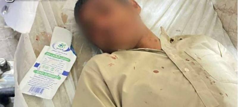 جابه‌جایی دانش‌آموزان با خودروی حمل سوخت/ تصادف شدید؛ حال یک دانش‌آموز وخیم است