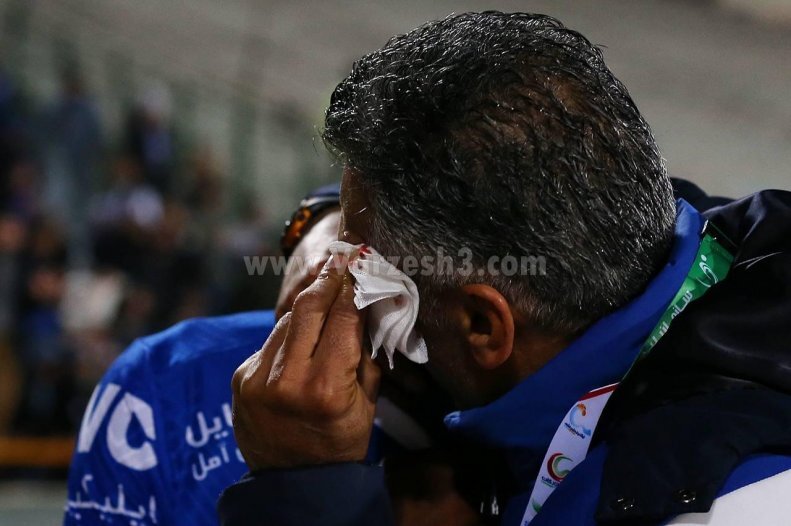 هاشمی نصب با صورت خونی سوژه شد! +عکس