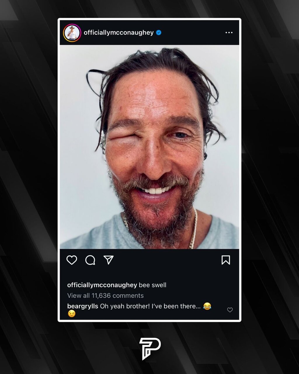 زنبورها صورت بازیگر سرشناس را به این روز انداختند! +عکس