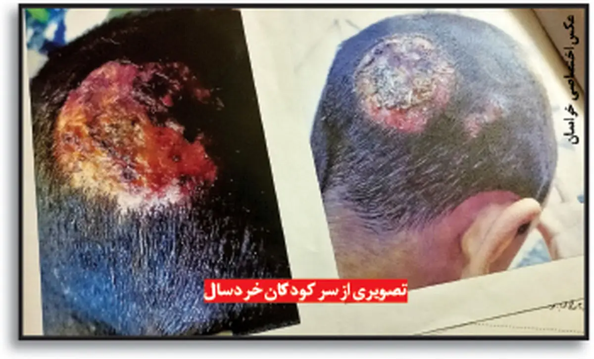 از کودکآزاری تا فروش گوشت الاغ در پرونده مردی که نفقه همسرش را نداد! +تصاویر دلخراش از کودکآزاری تا فروش گوشت الاغ در پرونده مردی که نفقه همسرش را نداد! +تصاویر دلخراش
