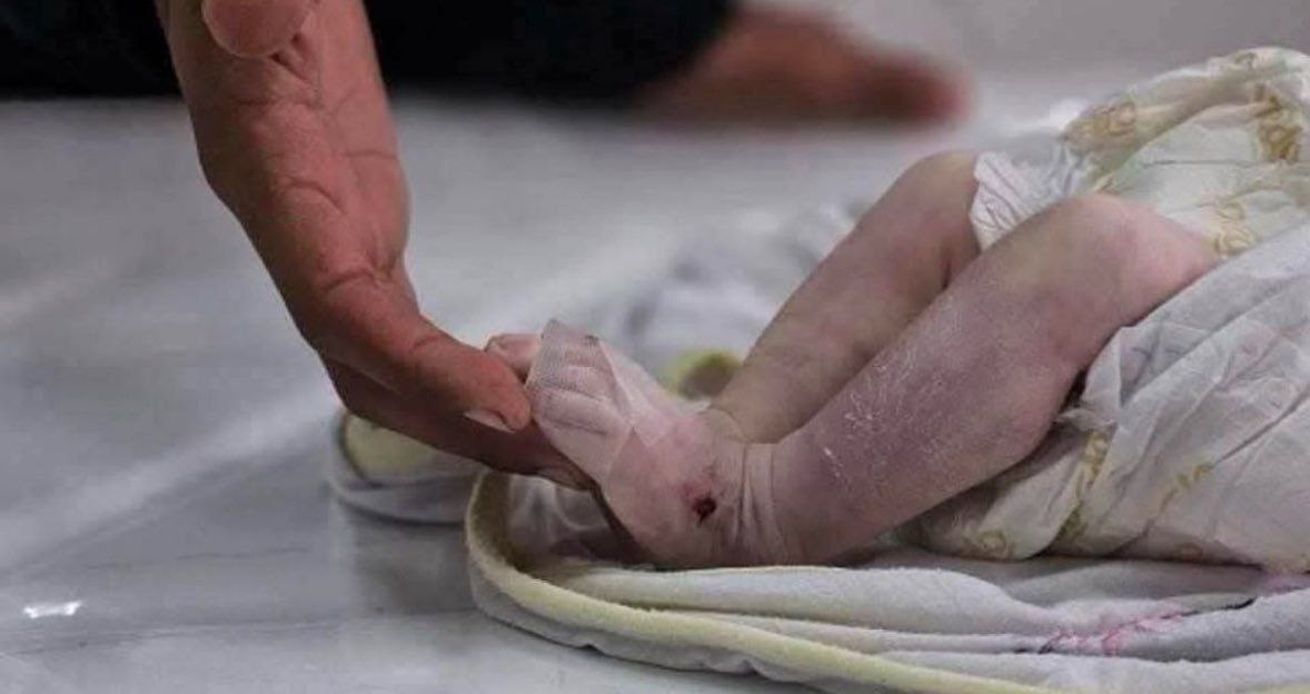 تصویر هولناک از این نوزاد جهان را در شوک فرو برد
