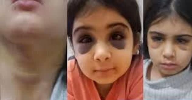 آزارهای وحشیانه مادرناتنی باردار به دختر ۹ساله؛ اگر پدر تعهد دهد آنیلا به کلبه وحشت برمیگردد! +عکس آزارهای وحشیانه مادرناتنی باردار به دختر ۹ساله؛ اگر پدر تعهد دهد آنیلا به کلبه وحشت برمیگردد! +عکس