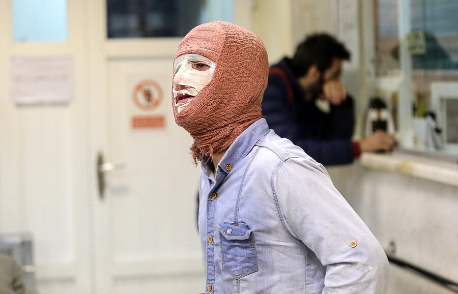 ۲۰۹ نفر چهارشنبهسوری نیامده مصدوم شدند! ۲۰۹ نفر چهارشنبهسوری نیامده مصدوم شدند!